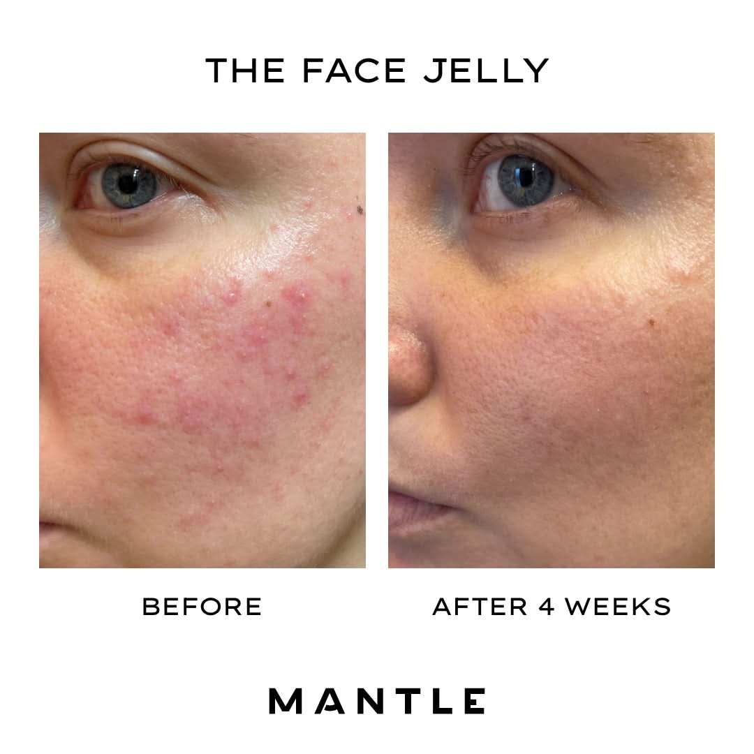 The Face Jelly - Image 5