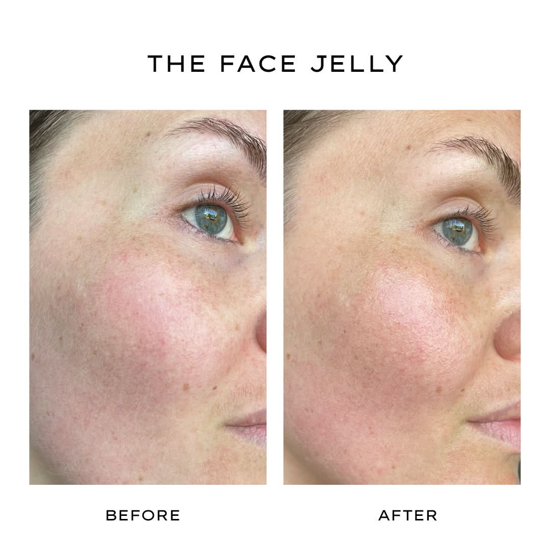 The Face Jelly - Image 6