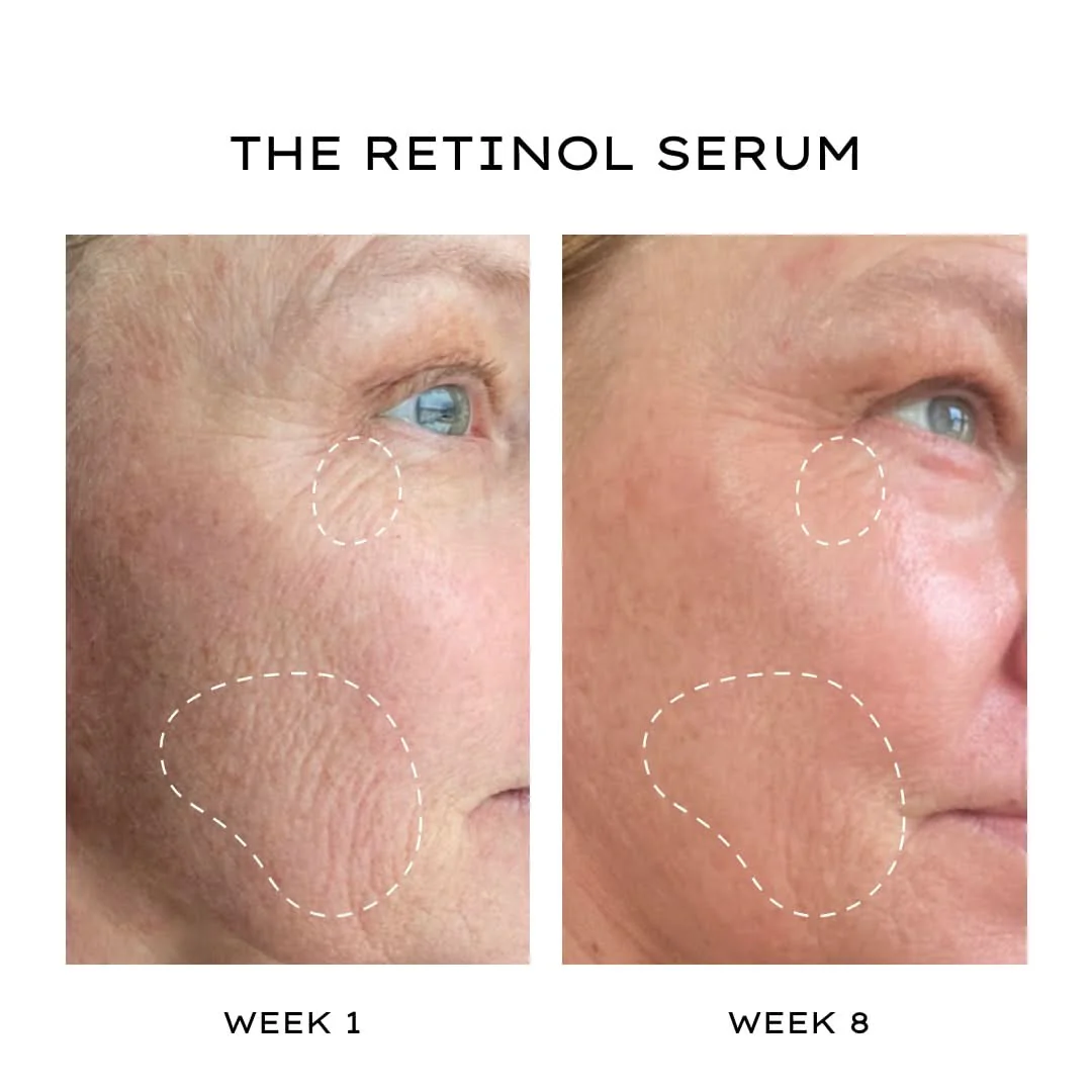 The Retinol Serum - Image 4
